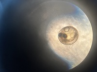 メダカの卵が見えました メダカの卵が見えました